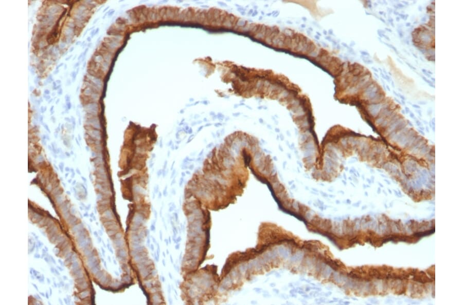 Immunohistochemistry - Anti-MUC1 Antibody [MUC1/967] (A249398) - Antibodies.com