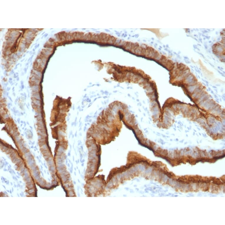 Immunohistochemistry - Anti-MUC1 Antibody [MUC1/967] (A249398) - Antibodies.com