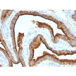 Immunohistochemistry - Anti-MUC1 Antibody [MUC1/967] (A249398) - Antibodies.com