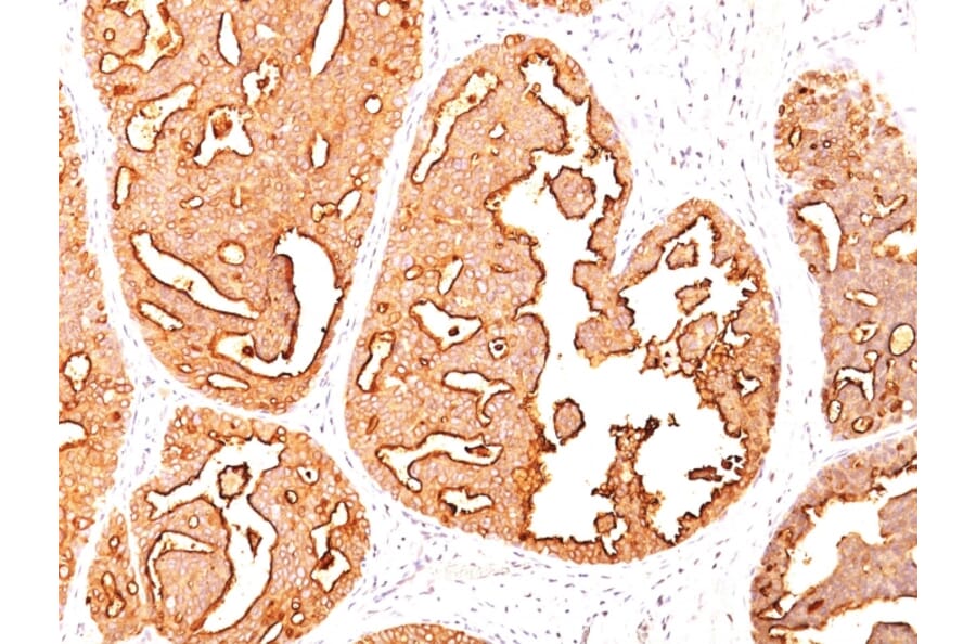 Immunohistochemistry - Anti-MUC1 Antibody [MUC1/967] (A249397) - Antibodies.com
