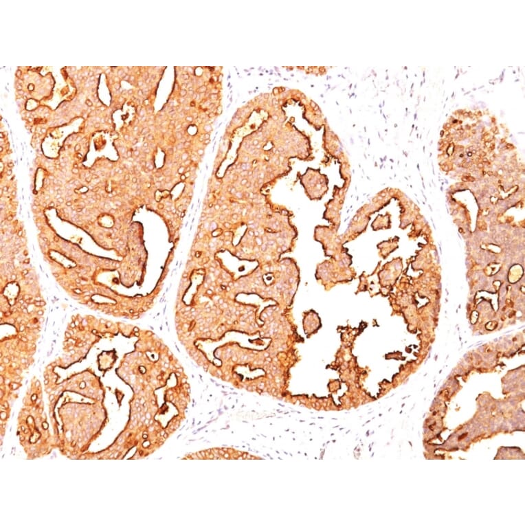 Immunohistochemistry - Anti-MUC1 Antibody [MUC1/967] (A249397) - Antibodies.com