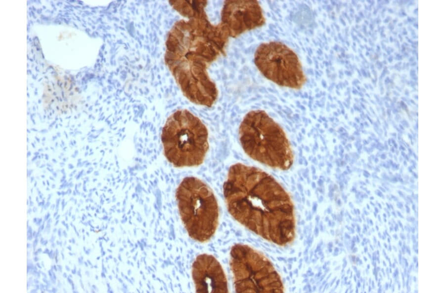 Immunohistochemistry - Anti-MUC1 Antibody [MUC1/967] (A249398) - Antibodies.com