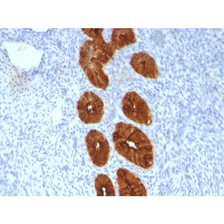 Immunohistochemistry - Anti-MUC1 Antibody [MUC1/967] (A249398) - Antibodies.com