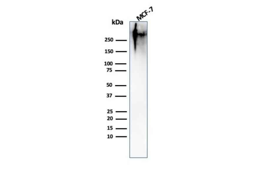 Western Blot - Anti-MUC1 Antibody [MUC1/967] (A249398) - Antibodies.com