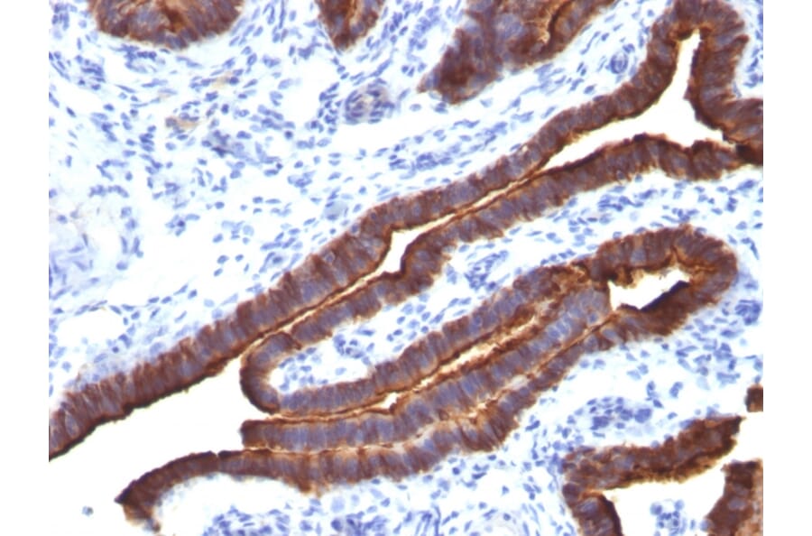 Immunohistochemistry - Anti-MUC1 Antibody [MUC1/520] (A249399) - Antibodies.com