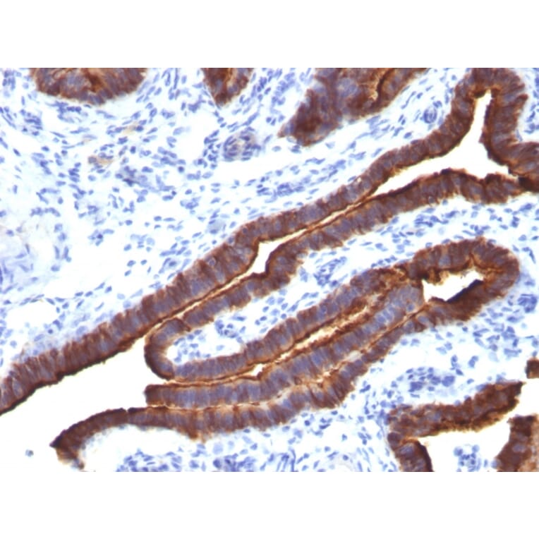 Immunohistochemistry - Anti-MUC1 Antibody [MUC1/520] (A249399) - Antibodies.com