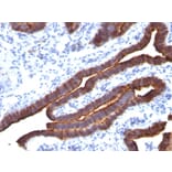 Immunohistochemistry - Anti-MUC1 Antibody [MUC1/520] (A249399) - Antibodies.com