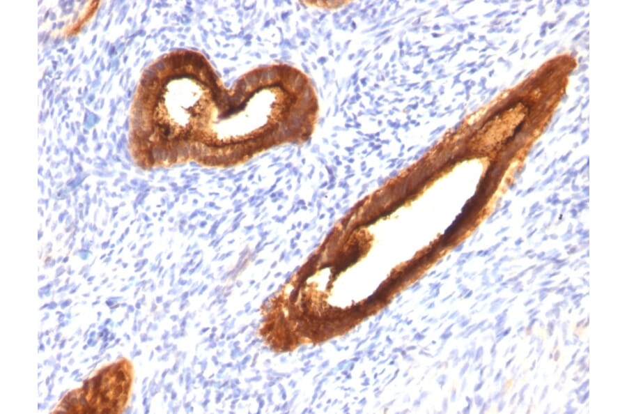 Immunohistochemistry - Anti-MUC1 Antibody [MUC1/520] (A249399) - Antibodies.com