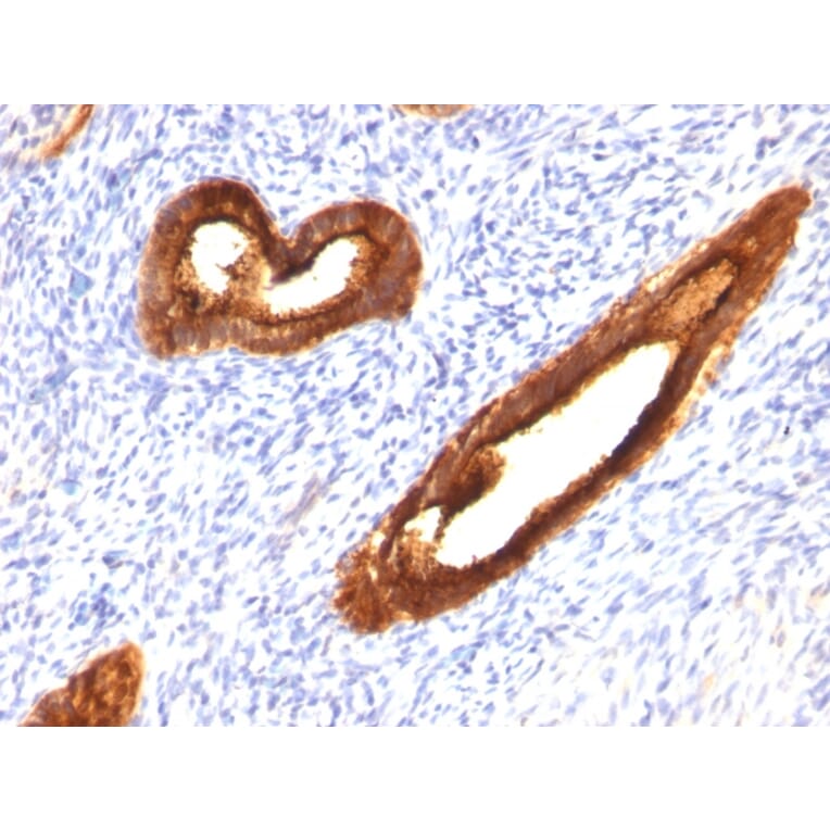 Immunohistochemistry - Anti-MUC1 Antibody [MUC1/520] (A249399) - Antibodies.com