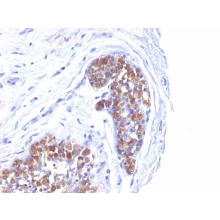 Immunohistochemistry - Anti-MUC1 Antibody [MUC1/520] (A249399) - Antibodies.com