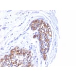 Immunohistochemistry - Anti-MUC1 Antibody [MUC1/520] (A249399) - Antibodies.com