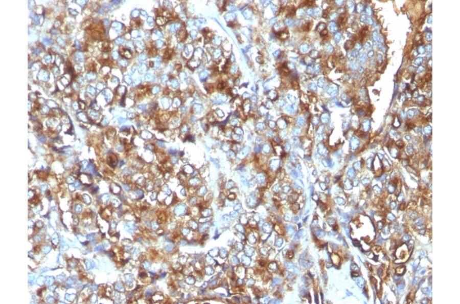 Immunohistochemistry - Anti-MUC1 Antibody [MUC1/520] (A249398) - Antibodies.com