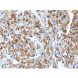 Immunohistochemistry - Anti-MUC1 Antibody [MUC1/520] (A249398) - Antibodies.com