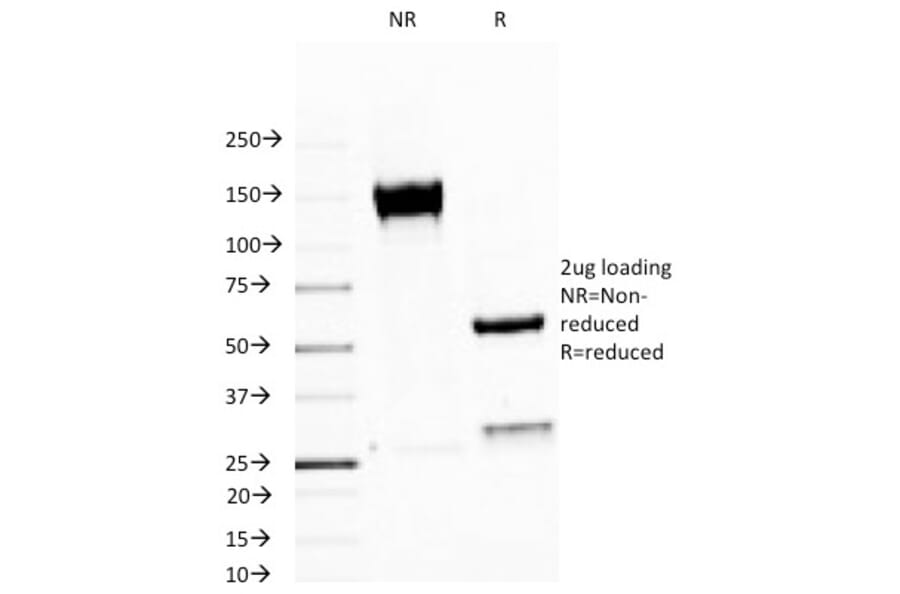 SDS-PAGE - Anti-MUC1 Antibody [MUC1/520] (A249399) - Antibodies.com