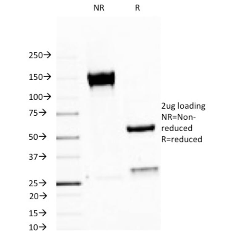 SDS-PAGE - Anti-MUC1 Antibody [MUC1/520] (A249399) - Antibodies.com