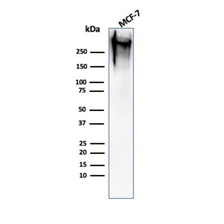 Western Blot - Anti-MUC1 Antibody [MUC1/520] (A249399) - Antibodies.com