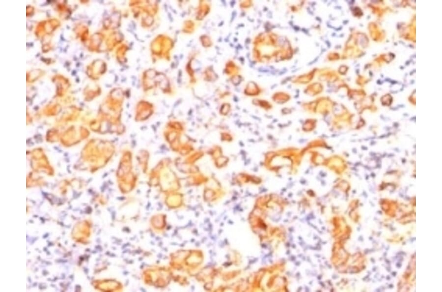 Immunohistochemistry - Anti-MUC1 Antibody [GP1.4] (A249399) - Antibodies.com