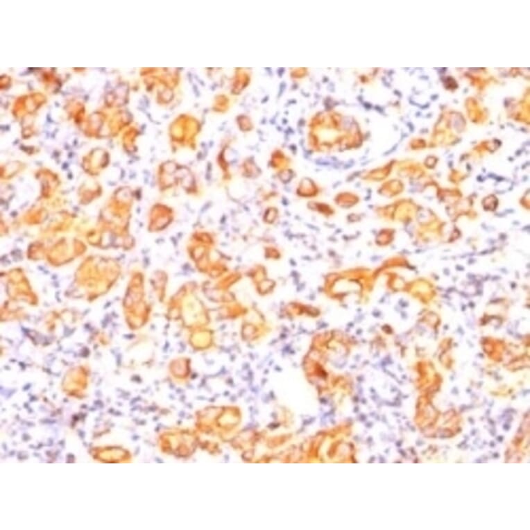 Immunohistochemistry - Anti-MUC1 Antibody [GP1.4] (A249399) - Antibodies.com
