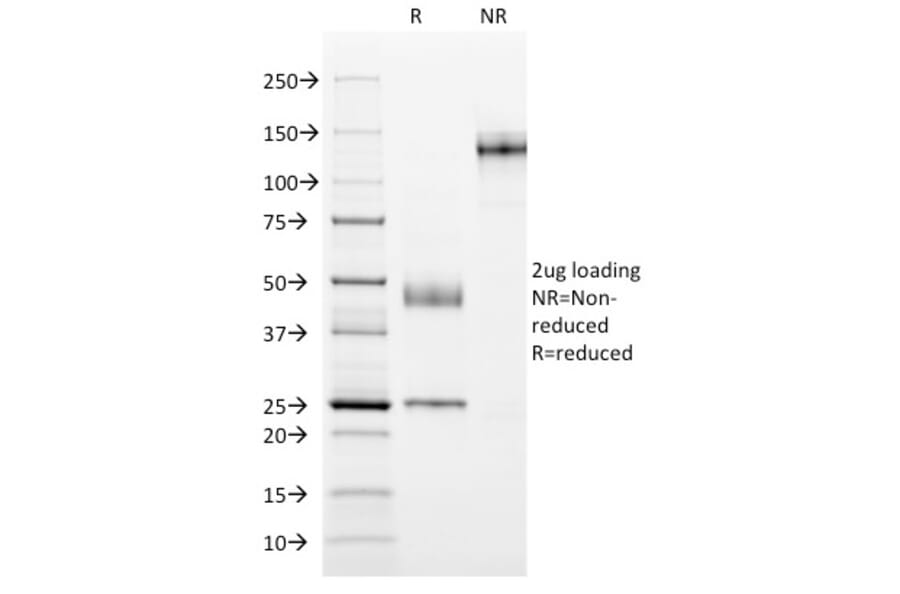 SDS-PAGE - Anti-MUC1 Antibody [GP1.4] (A249400) - Antibodies.com