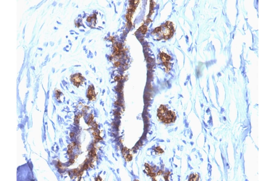 Immunohistochemistry - Anti-MUC1 Antibody [SPM132] (A249400) - Antibodies.com