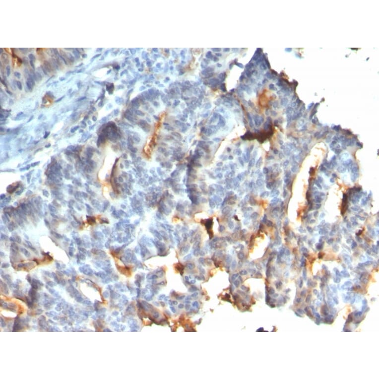Immunohistochemistry - Anti-MUC1 Antibody [rMUC1/955] (A249401) - Antibodies.com