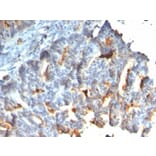 Immunohistochemistry - Anti-MUC1 Antibody [rMUC1/955] (A249401) - Antibodies.com