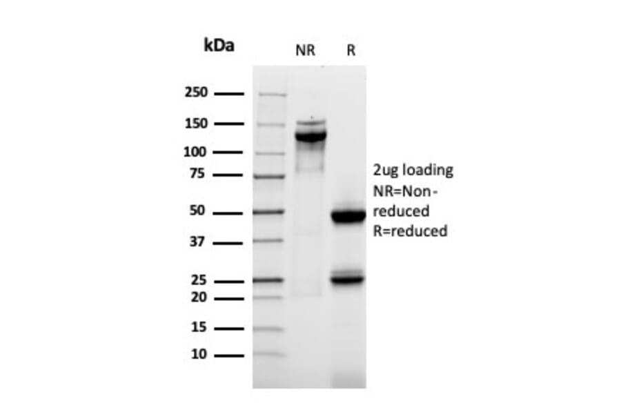 SDS-PAGE - Anti-MUC1 Antibody [rMUC1/955] (A249402) - Antibodies.com