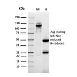SDS-PAGE - Anti-MUC1 Antibody [rMUC1/955] (A249402) - Antibodies.com