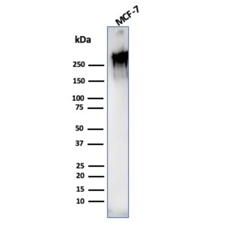 Western Blot - Anti-MUC1 Antibody [rMUC1/955] (A249402) - Antibodies.com