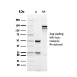 SDS-PAGE - Anti-MUC1 Antibody [rMUC1/4418] (A249403) - Antibodies.com