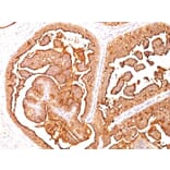 Immunohistochemistry - Anti-MUC1 Antibody [E29] (A249403) - Antibodies.com