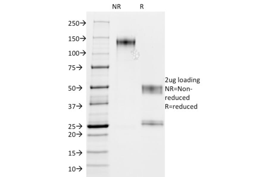 SDS-PAGE - Anti-MUC1 Antibody [GP1.4 + E29] (A249406) - Antibodies.com