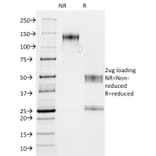 SDS-PAGE - Anti-MUC1 Antibody [GP1.4 + E29] (A249406) - Antibodies.com