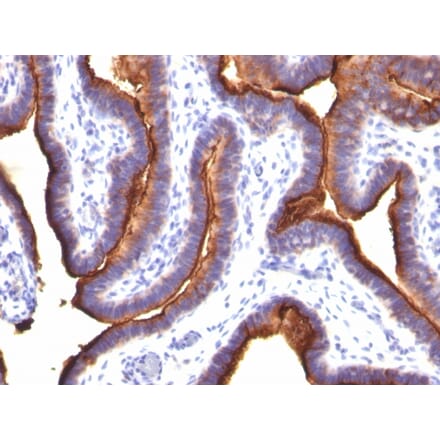 Immunohistochemistry - Anti-MUC1 Antibody [MUC1/845] (A249407) - Antibodies.com