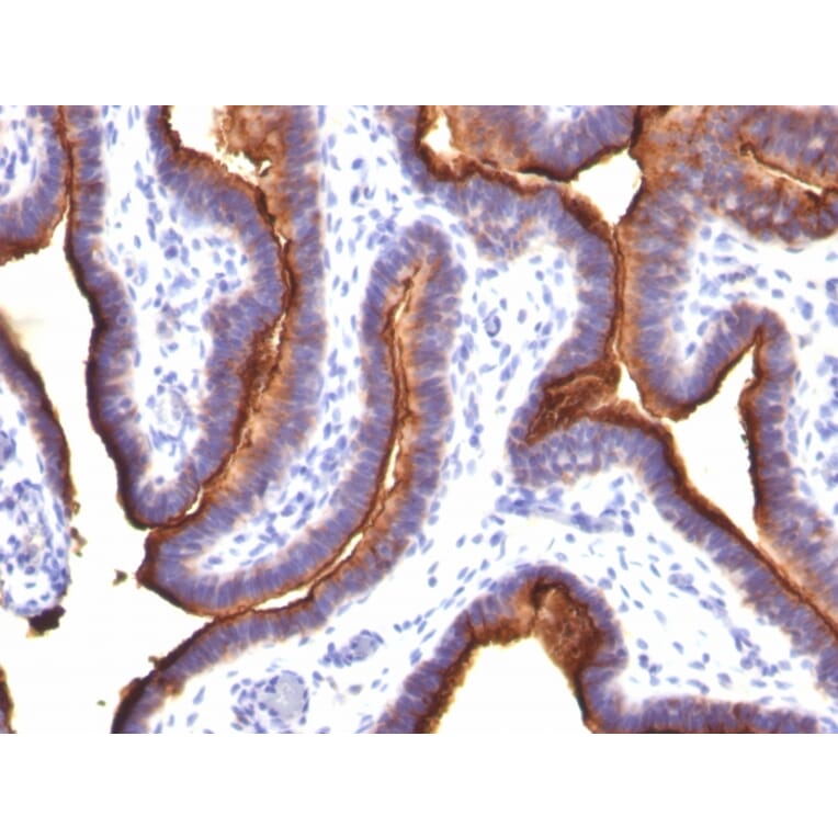 Immunohistochemistry - Anti-MUC1 Antibody [MUC1/845] (A249407) - Antibodies.com