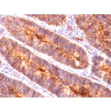 Immunohistochemistry - Anti-MUC1 Antibody [MUC1/845] (A249407) - Antibodies.com