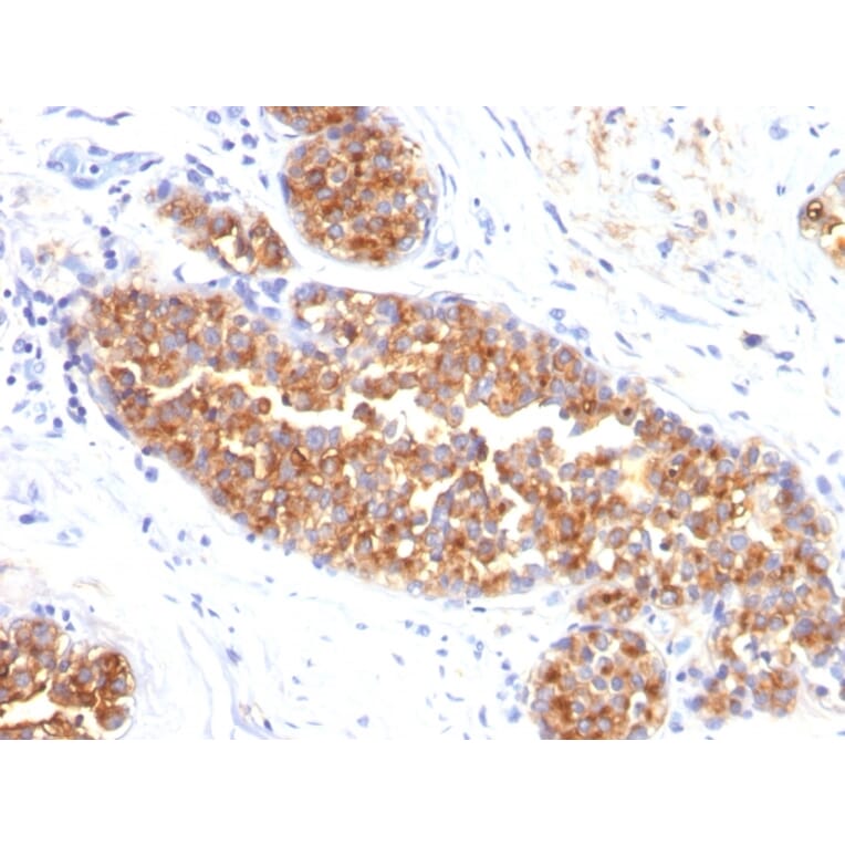 Immunohistochemistry - Anti-MUC1 Antibody [MUC1/845] (A249407) - Antibodies.com
