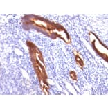 Immunohistochemistry - Anti-MUC1 Antibody [MUC1/845] (A249407) - Antibodies.com