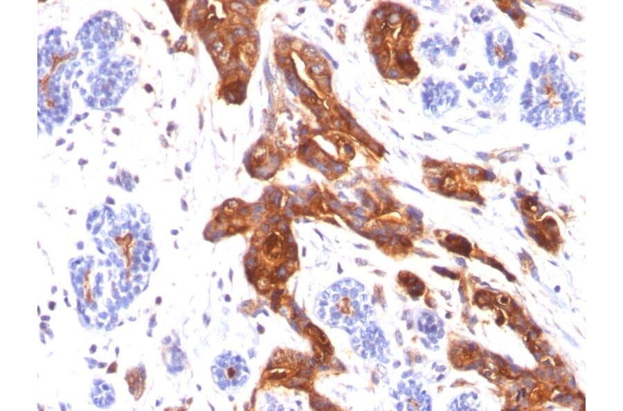 Immunohistochemistry - Anti-MUC1 Antibody [MUC1/845] (A249406) - Antibodies.com