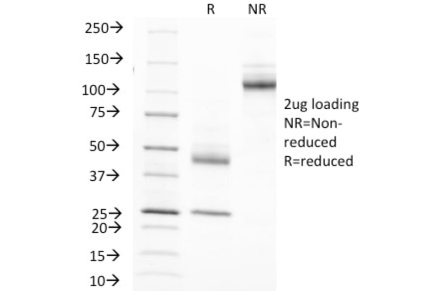 SDS-PAGE - Anti-MUC1 Antibody [MUC1/845] (A249407) - Antibodies.com