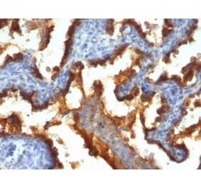 Immunohistochemistry - Anti-MUC1 Antibody [139H2] (A249408) - Antibodies.com