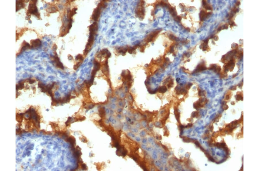 Immunohistochemistry - Anti-MUC1 Antibody [139H2] (A249408) - Antibodies.com
