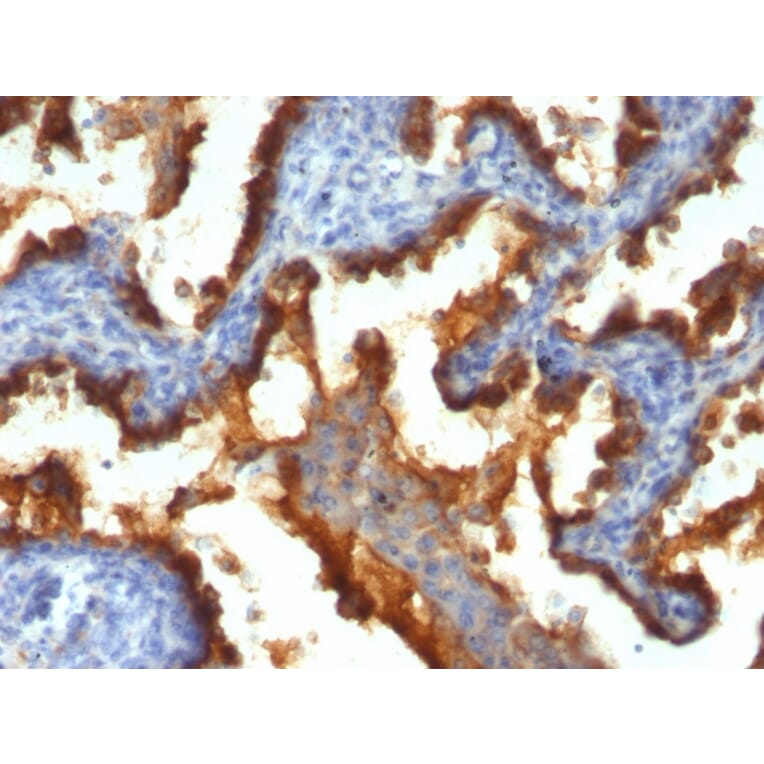 Immunohistochemistry - Anti-MUC1 Antibody [139H2] (A249408) - Antibodies.com