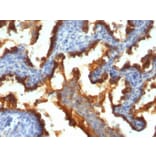 Immunohistochemistry - Anti-MUC1 Antibody [139H2] (A249408) - Antibodies.com
