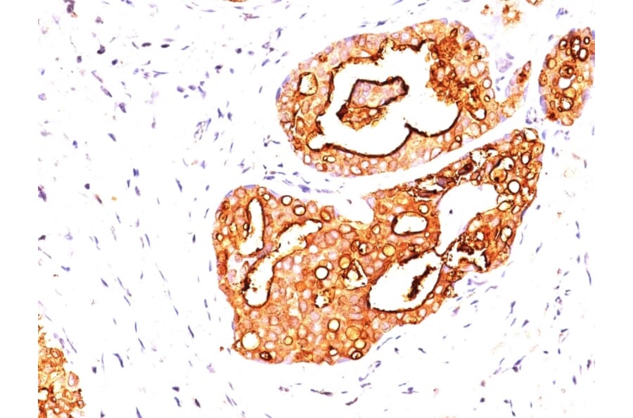 Immunohistochemistry - Anti-MUC1 Antibody [139H2] (A249407) - Antibodies.com