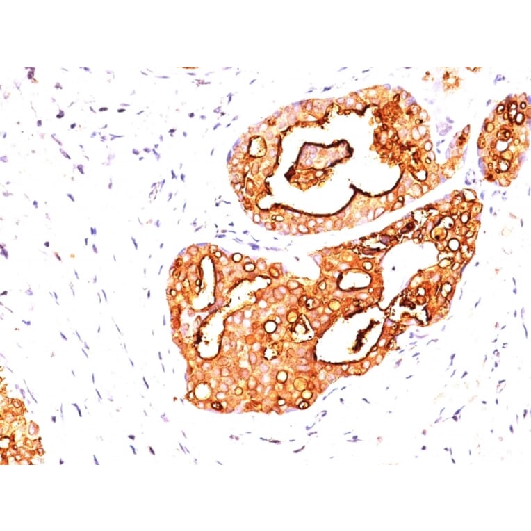 Immunohistochemistry - Anti-MUC1 Antibody [139H2] (A249407) - Antibodies.com