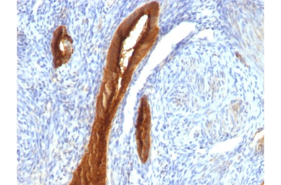Immunohistochemistry - Anti-MUC1 Antibody [139H2] (A249408) - Antibodies.com