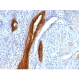 Immunohistochemistry - Anti-MUC1 Antibody [139H2] (A249408) - Antibodies.com