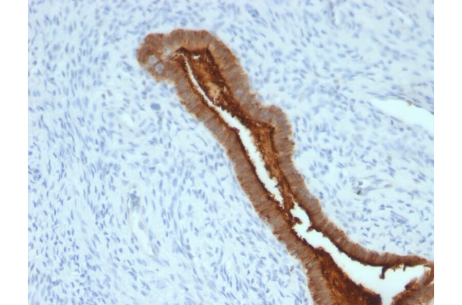 Immunohistochemistry - Anti-MUC1 Antibody [SPM492] (A249408) - Antibodies.com
