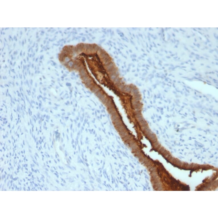 Immunohistochemistry - Anti-MUC1 Antibody [SPM492] (A249408) - Antibodies.com